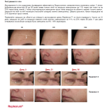 Антивіковий ліфтинговий крем MODAY Syn-Ake Cream Complex Peptide 6-in-1  на основі 5 видів пептиду та Syn-Ake 30 мл